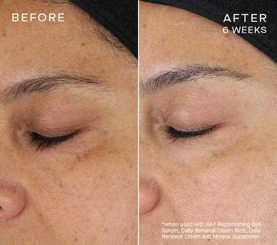 HA+ Replenishing Eye Serum