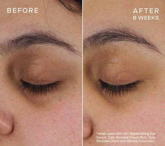 HA+ Replenishing Eye Serum