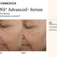 TNS Advanced+ Serum