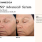 TNS Advanced+ Serum