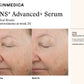 TNS Advanced+ Serum