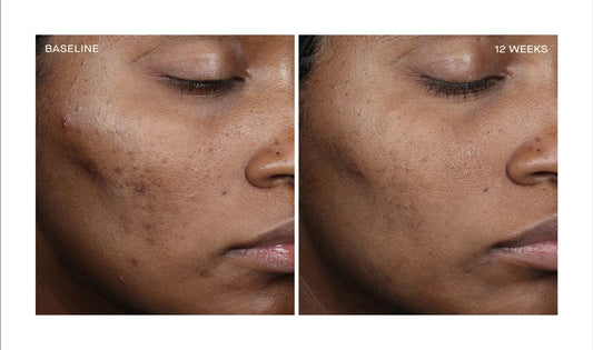 Ourself Complexion Brightening Serum