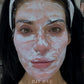 Microneedling